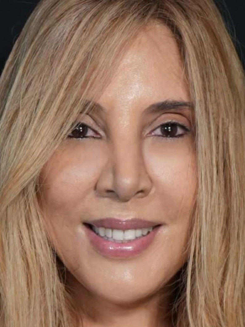 Dr. Jeannette Barrueta, MD