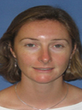 Dr. Kristen Smith, MD
