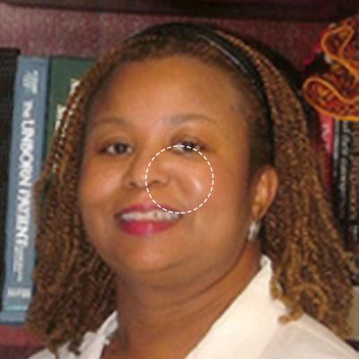 Dr. Joanie Hare, MD