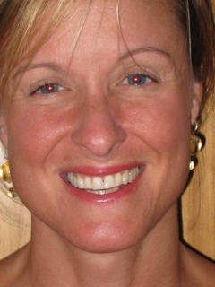 Dr. Sharon Meglathery, MD