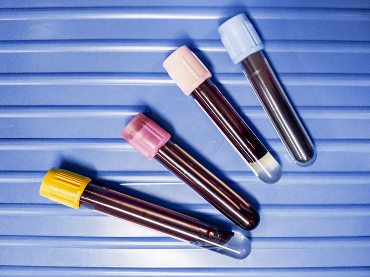 Follicle-Stimulating Hormone: What Is an FSH Test Used For?