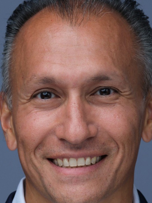 Dr. Fermin Barrueto, MD